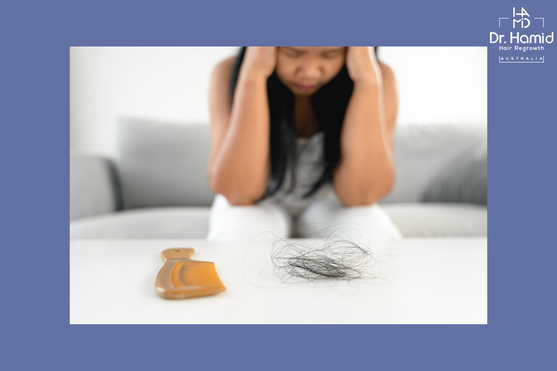 Female Hair Loss: Latest Treatments and Regrowth Options